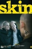 Скин